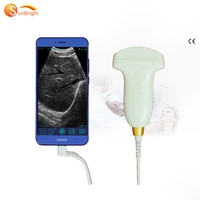 direct manufacturer usb mobile phone ultrasound probe usb obgyn msk ultrasound scannerecho machine sun p1