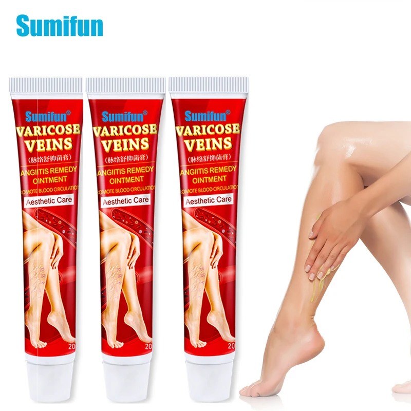 

Sumifun Varicose Veins Treatment Cream Vasculitis Phlebitis Angiitis Inflammation Blood Vessel Rotten Leg Spider Repair Ointment