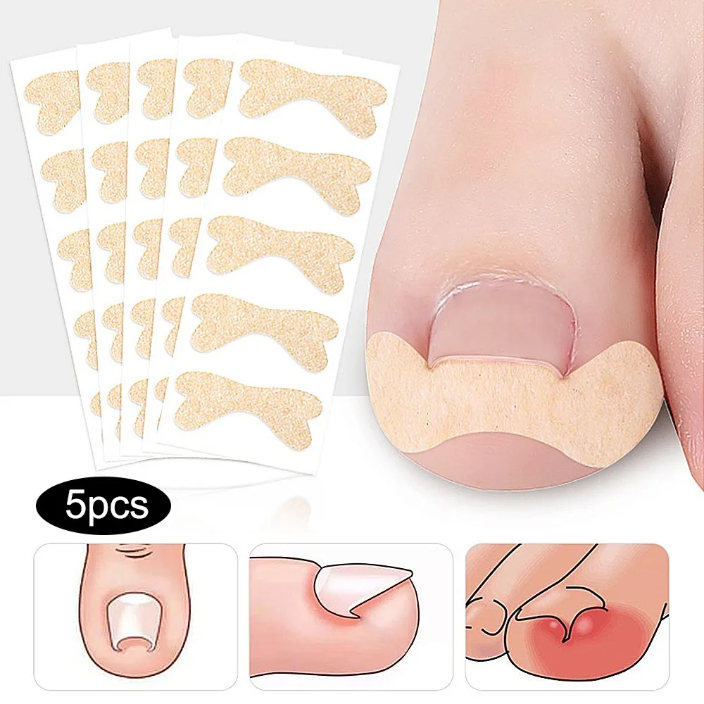 

Bunion Corrector Ingrown Toenail Corrector Sticker Paronychia Treatment Fixer Recover bunion Pedicure Foot Toe Nail Care Tool