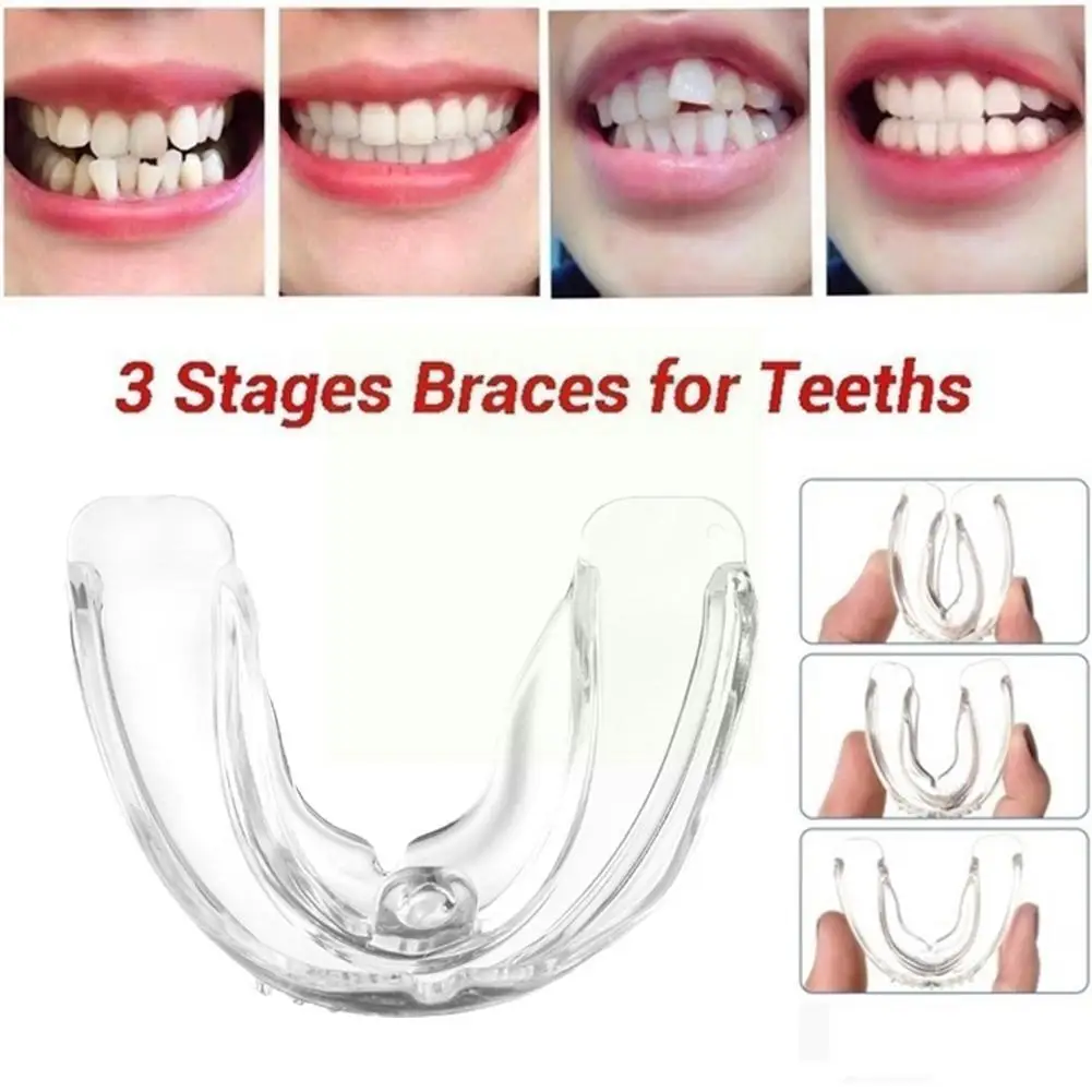 

Orthodontic Braces Dental Braces Smile Teeth Alignment Braces Retainer Silicone Tray Tooth Mouth Guard Instanted Teeth Trai M6E8