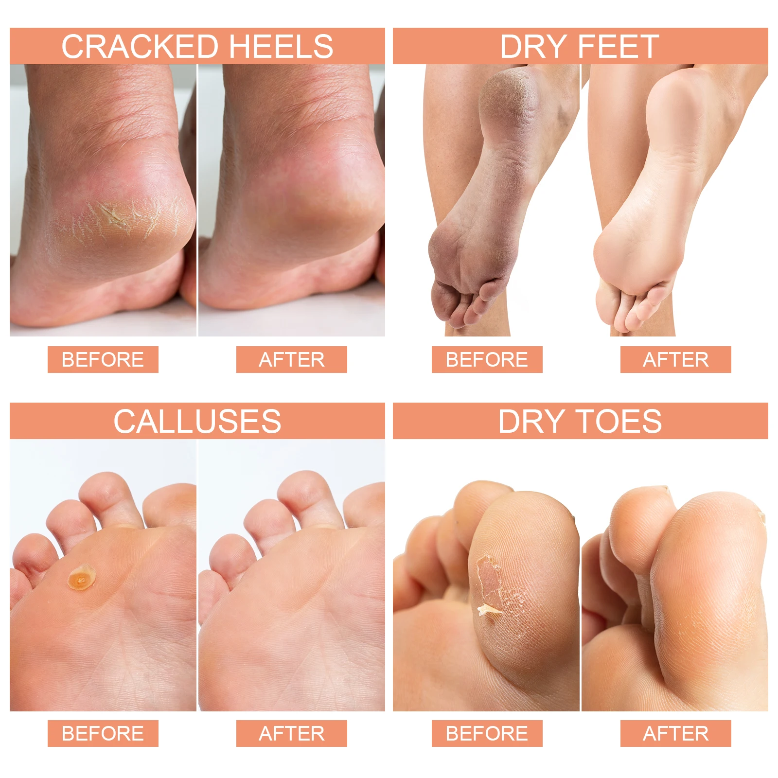 

Exfoliating Feet Mask Exfoliating Foot Mask Socks Pedicure Peeling Dead Skin Remover Feet Mask Peel Foot Care Tool Moisturizing