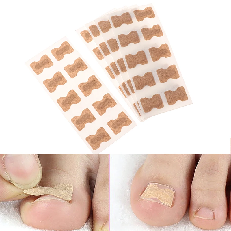 

10Pcs/50Pcs Nail Art Ingrown Correction Sticker Foot Care Pedicure Tool Fixer Paronychia Recover Toenail Elastic Patch Corrector