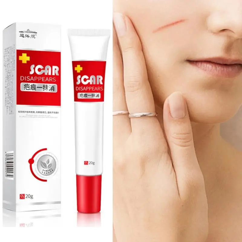20ml Scar Treatment Cream Whitening Cream Skin Repair Repair Scar Treatment Face Stretch Acne Cream Cream A8X8