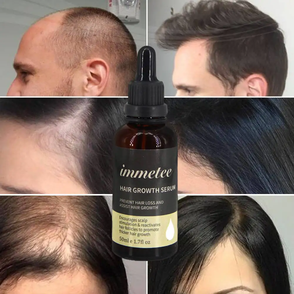 

Hair Growth Treatment Essence Oil Natural Healthy For Anti Hair Loss Essence Fast Thick Hair Eyebrow Support Hair Care Products