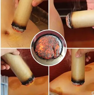 1 коробка ai core thunder fire moxibustion Артикул три года ручная грубая мокса Чэнь конус для