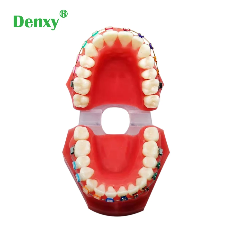Стоматологическая Ортодонтическая модель Denxy с ортодонтическим металлическим