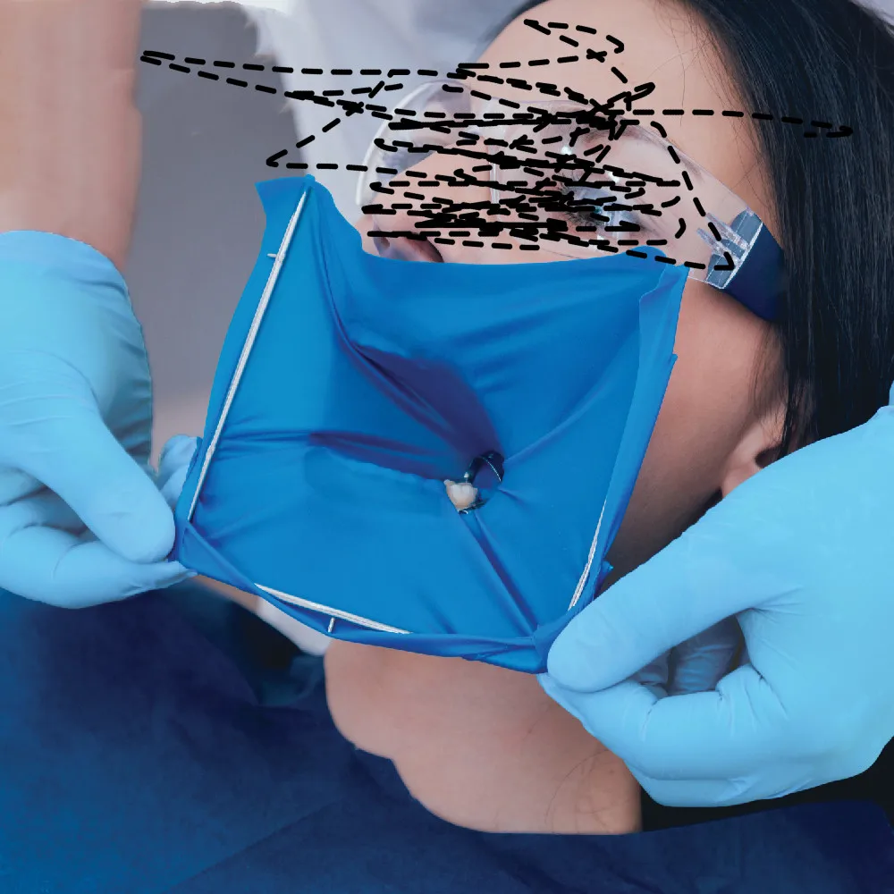 

Dental Endodontic Rubber Dam Natural Latex Medium 6''X6'' 36Sheets/Box Blue Color