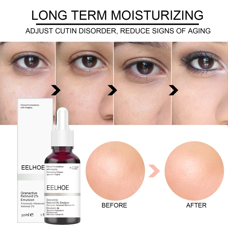 

Anti Acne Exfoliating Face Serum Peeling Solution Pore Shrinking Repairing Smoot Serum Oil-Control Firming Moisturizing