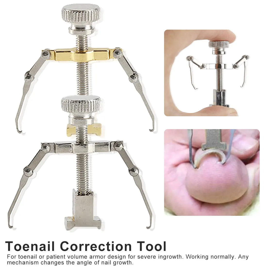 

Фиксатор для вросших ног, устройство для коррекции межпальцевой зоны, лечение и выпрямление