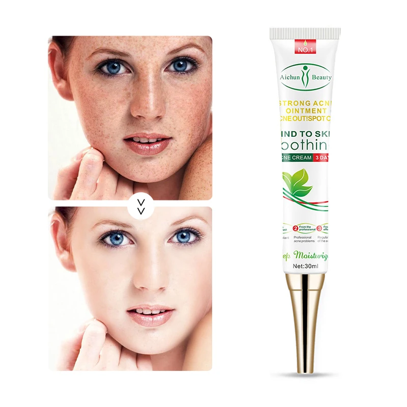 

Effective Whitening Freckle Cream Remove Melasma Acne Spot Pigment Melanin Dark Spots Pigmentation Moisturizing Gel Skin Care