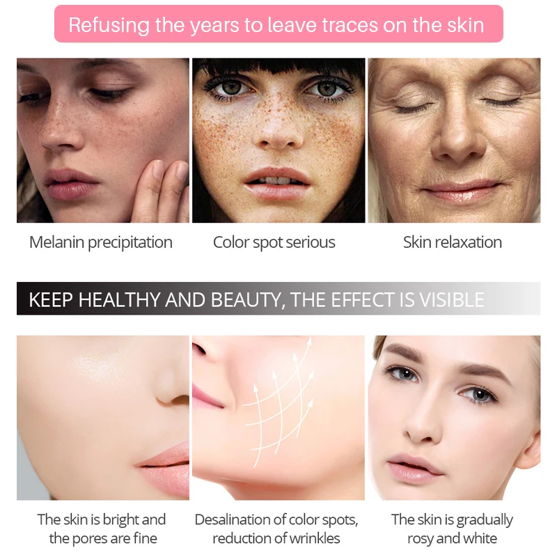 

EFERO facial whitening cream freckle remover melasma acne blemishes lightening melanin moisturizer