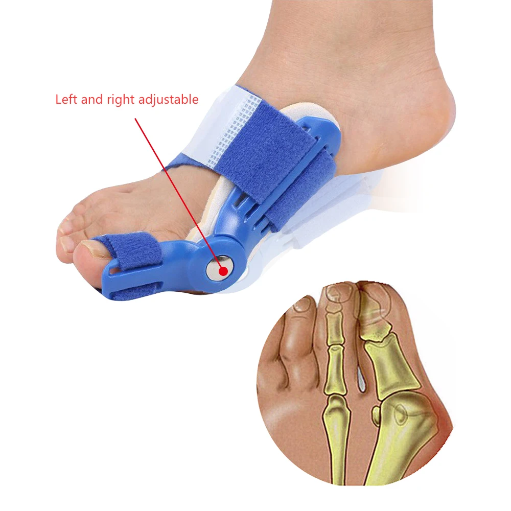 1 пара ортопедических брекетов для большого ухода за костями коррекция Bunion