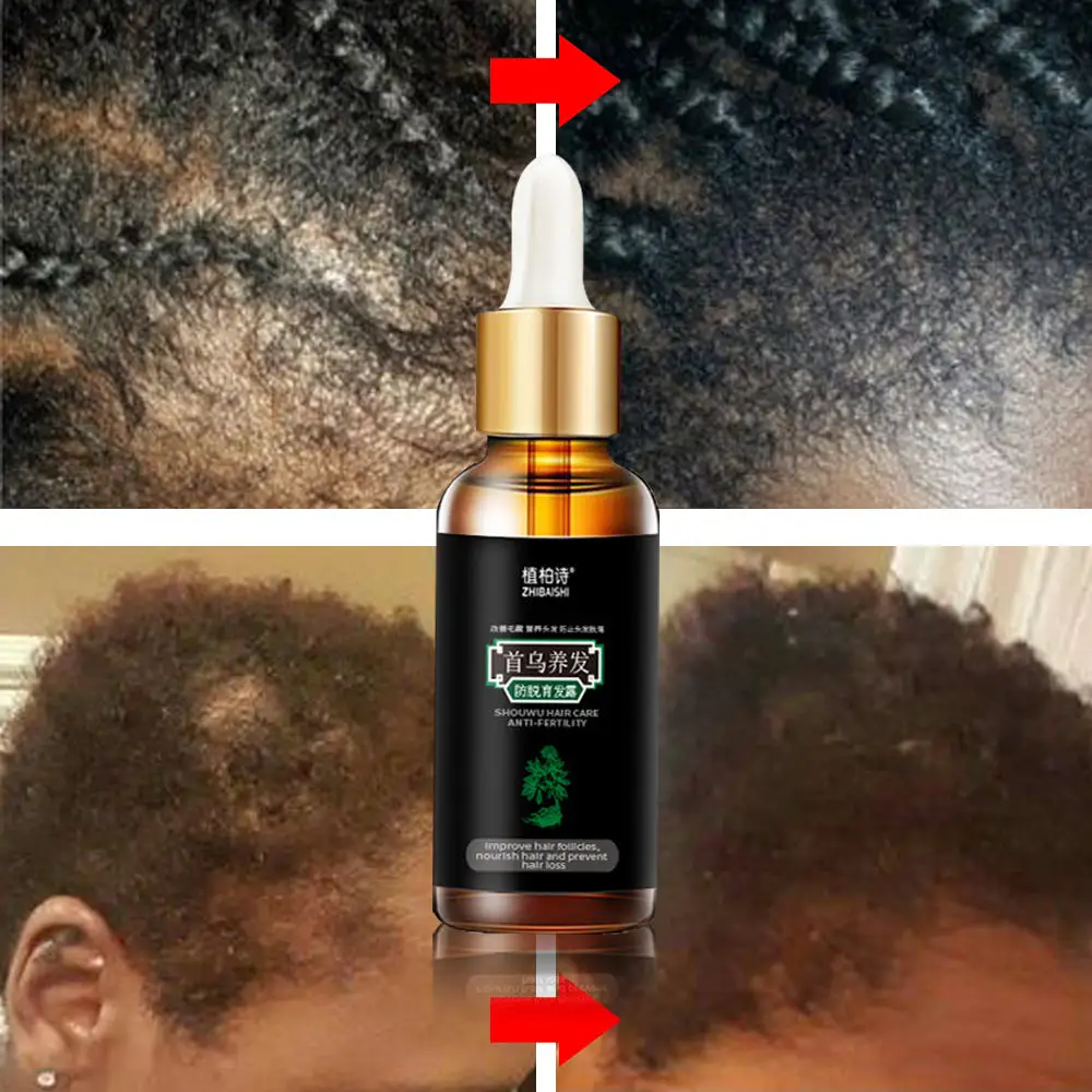 Средство для ухода за волосами против выпадения волос|Средства от волос| |