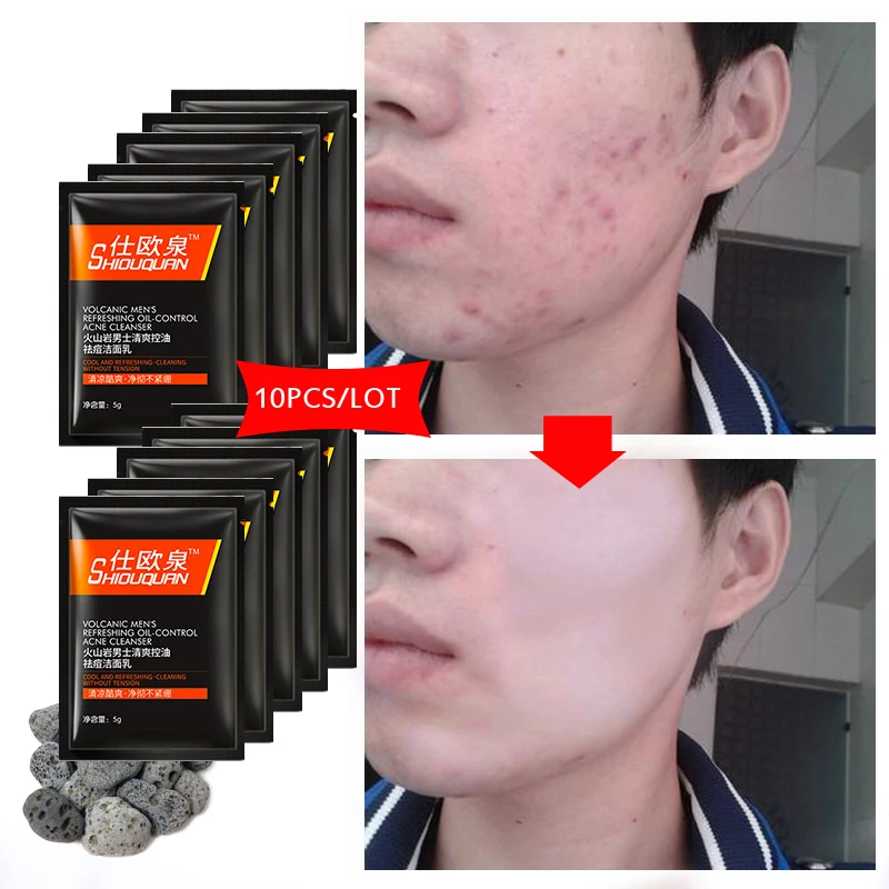 Средство для ухода за кожей лица средство увлажняющее удаления акне очищение пор