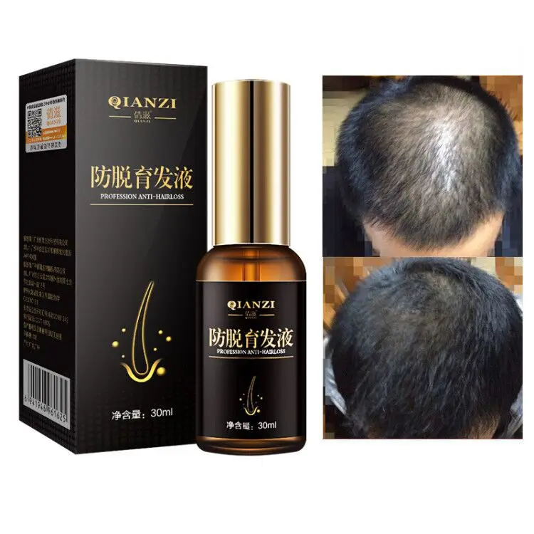 

Fast Hair Grow Essence Serum Anti Hair Loss Treatment Promote Hair Follicle Growth Nourishing Hair Regeneration Repair