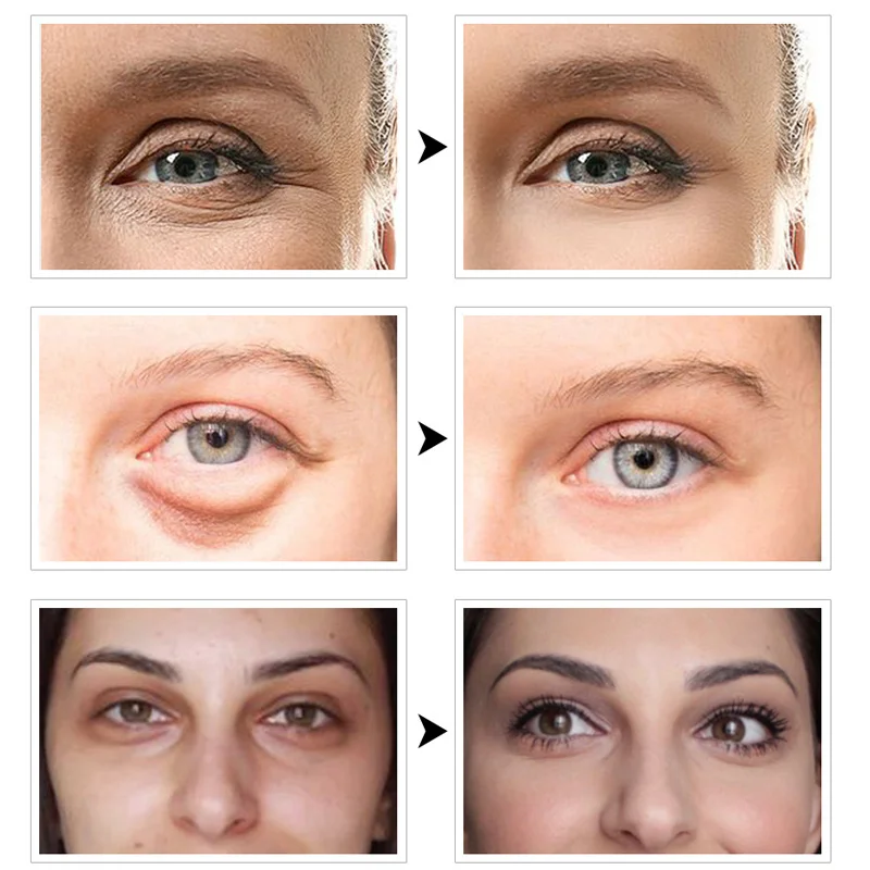 60 шт. маска для глаз коллагеновые гелевые патчи под глазами мешки удаления темных