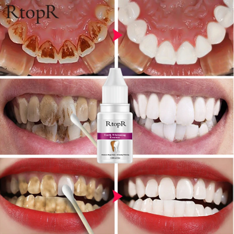 Отбеливающая эссенция для гигиены полости рта ежедневного использования