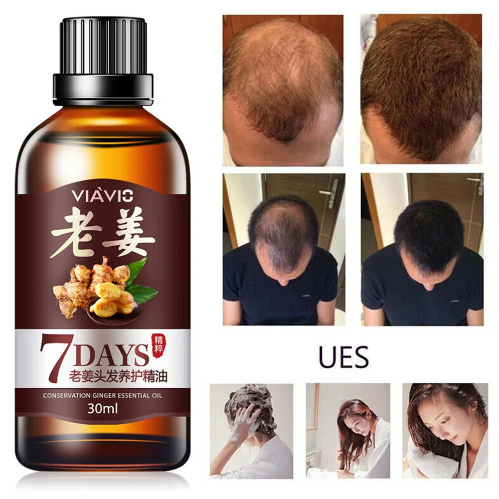 

30ml Thicker Treatment Hair Growth Maintenance Ointment Moisturizing Fast Ginger Ingredients Anti Loss Longer Essence Oil