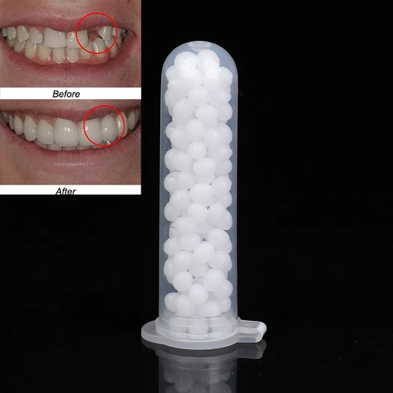 Temporary Tooth Repair Kit Teeth And Gaps False Solid Glue Denture Adhesive Whitening Beauty Tool | Красота и здоровье