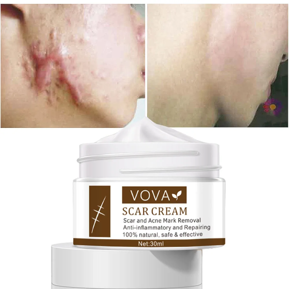 

VOVA Scar Cream Remove Scar Acne Mark Removal Anti Inflammatory Repairer Skin Pigment Precipitation Gel Ointment Products 30ml