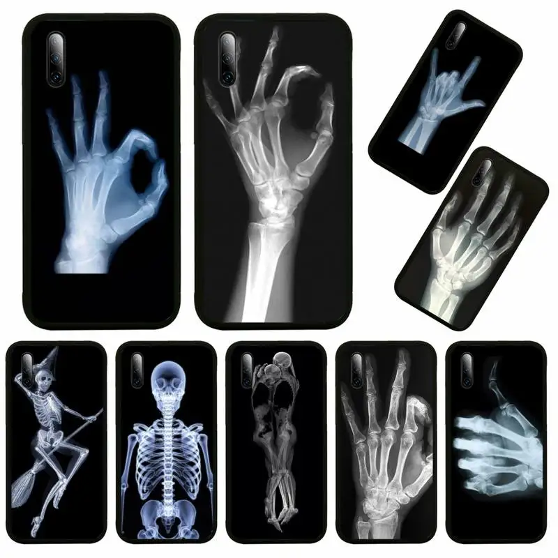

X-ray Hand Bones Phone Case For Samsung A6 A7 A8 A10 A11 A20 A21 A30 A31 A40 A50 A70 A80 A91 Plus S E Coque