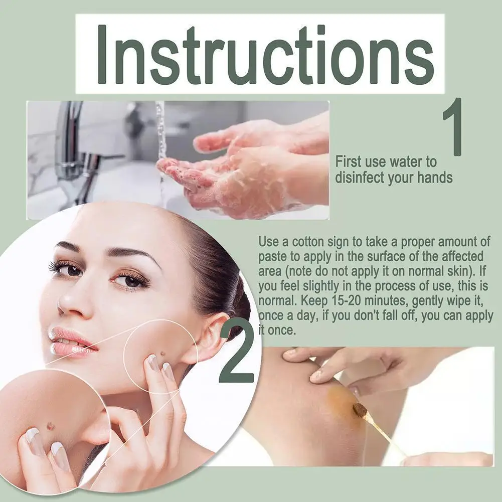 

15ml Skin Tag Remover Liquid Wart Treatment Instant Removal Corn Mole&papillomas Tool Foot Bacteriostatic Liquid Natural Re L6k7