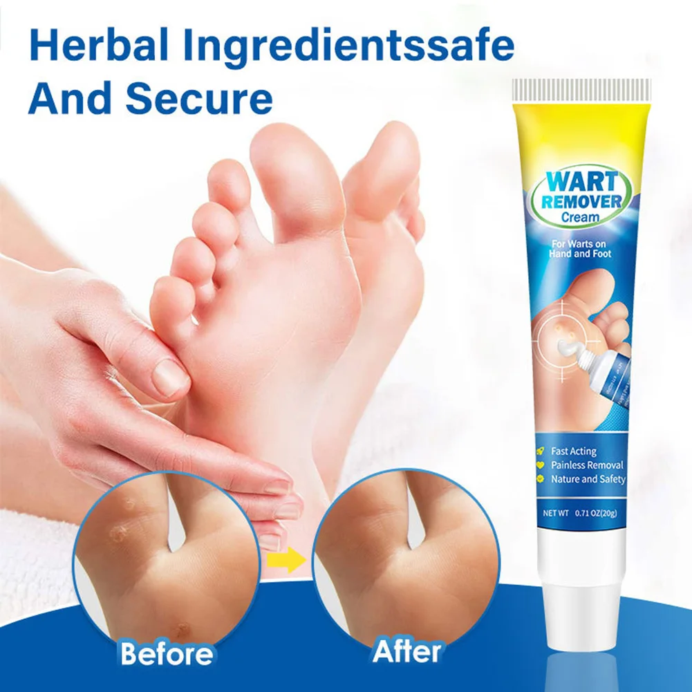 

20g Warts Remover Antibacterial Ointment Wart Treatment Cream Skin Tag Remover Herbal Extract Corn Plaster Warts Ointment
