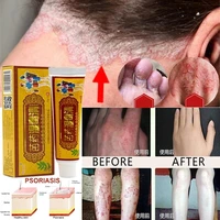 2 piece health care skin fungus anti bacterial cream natural chinese herbs cream onitment for psoriasis dermatitis eczema treatm