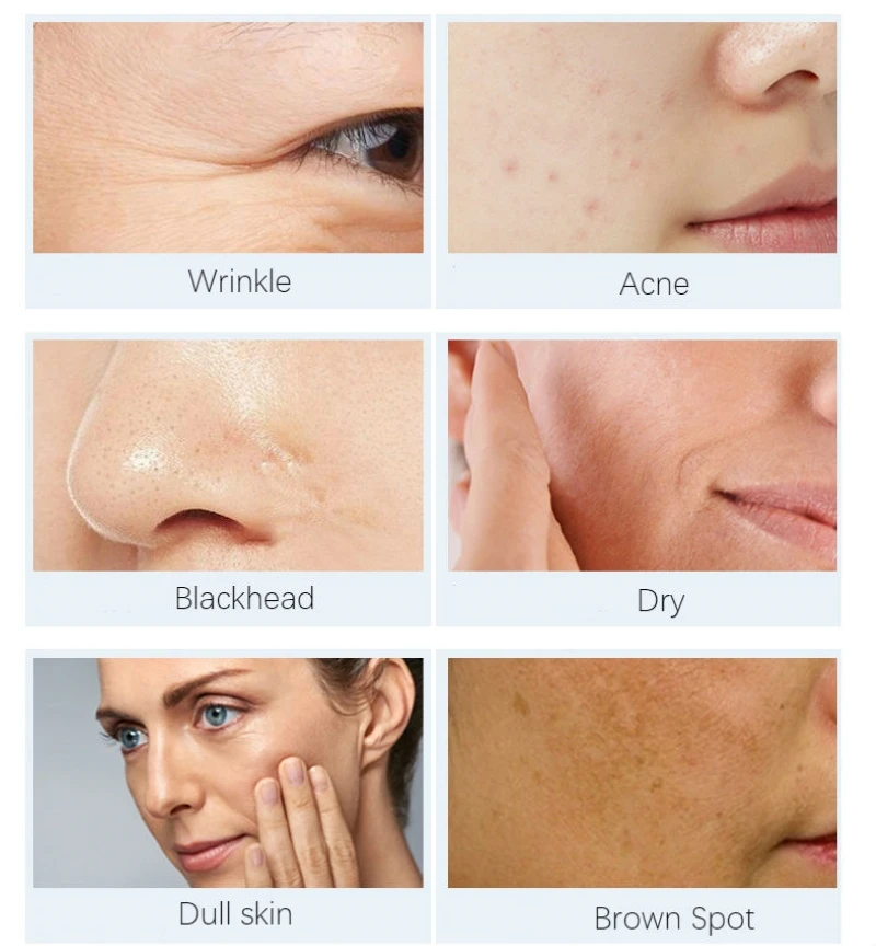 Chumolee шесть сыворотка с пептидами и гиалуроновой кислотой 25 мл анти старения