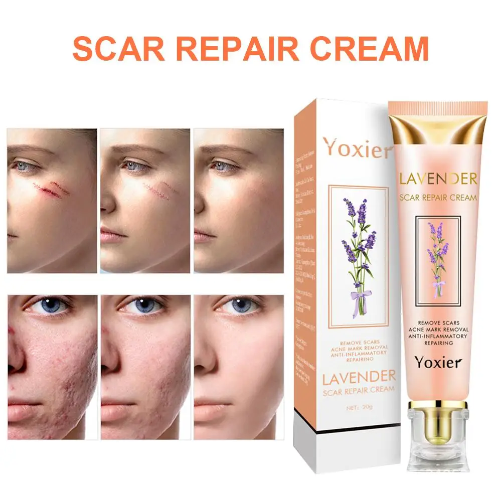 Крем для удаления шрамов от акне и растяжек крем восстановления кожи лица