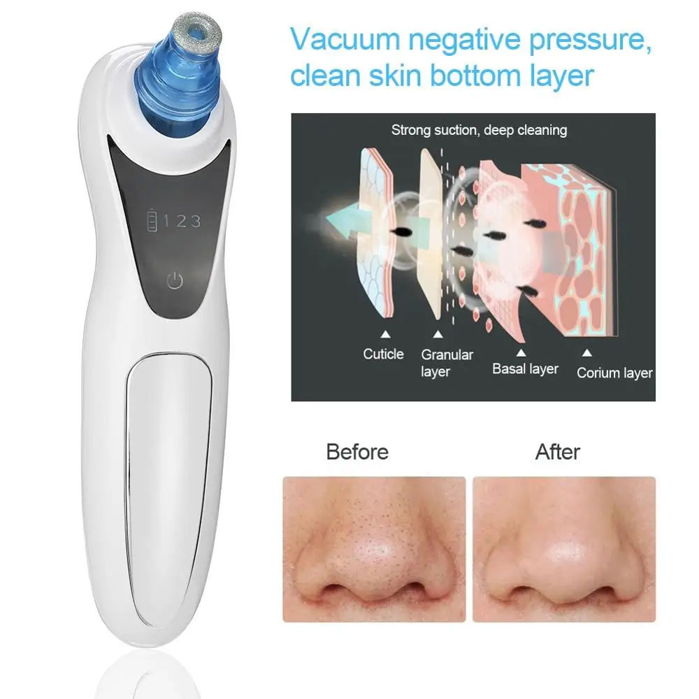 

Newest USB Electric Blackhead Acne Hand-Held Facial Cleansing Fades Fines lines Increase Skin Elasticity Beauty Care Instruments