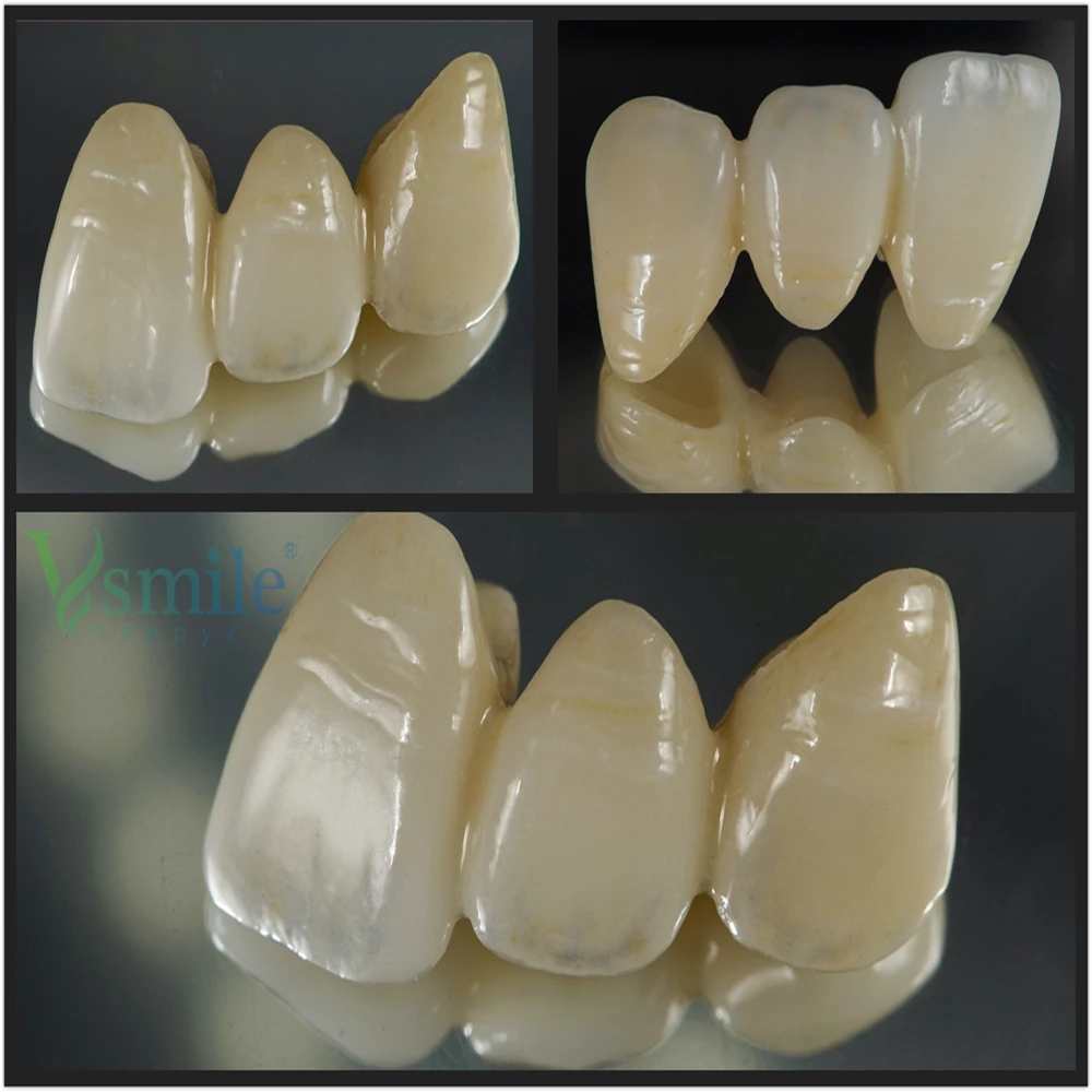 

3D PRISM Multilayer Zirconia Blank with Vita 16 + OM1/2/3 Preshaded Zirconium Dental Material for Open CADCAM System