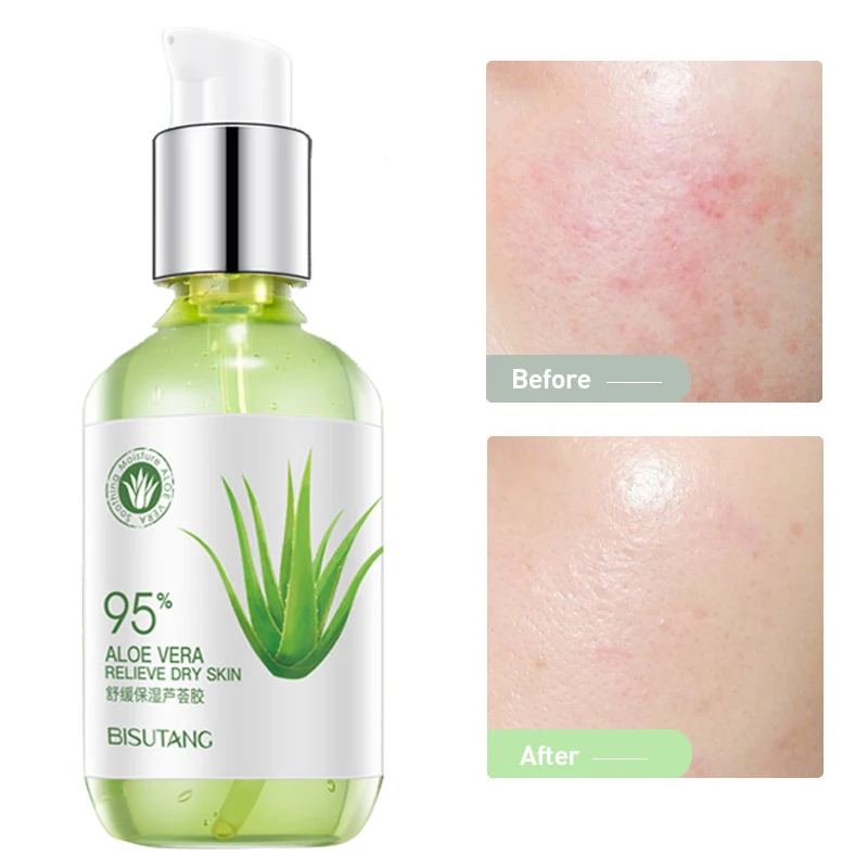 

Aloe Vera Gel Anti-Acne Moisturizing After Sun Care Lotion Remove Acne Marks Oil Control Shrink Pores Repair Skin Care Products