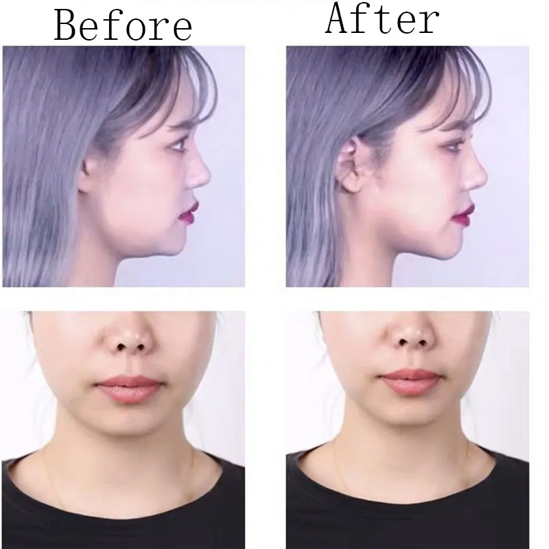 Маленькая V палочка для лица матовая невидимая двойной подбородок туго тянется