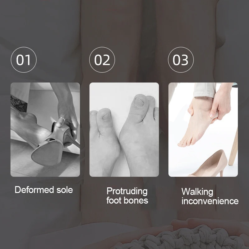 

2pcs Soft Elastic Toe Separators Gel Silicone Bunion Corrector Straightener Spreader Foot Care Tool Hallux Valgus Orthopedic Kit