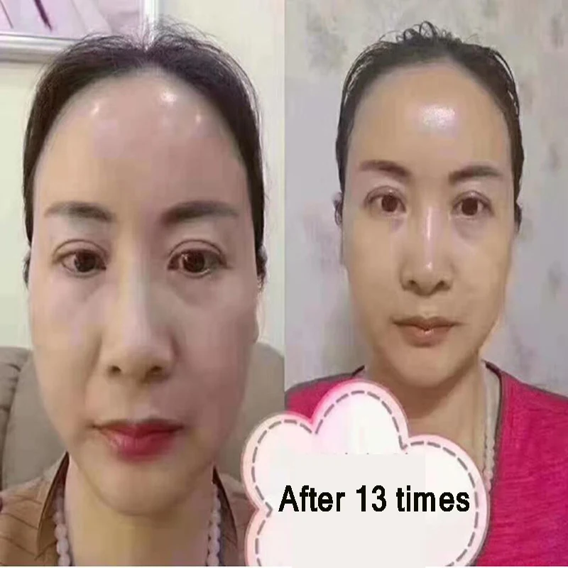 3D Hifu маска для лица кисточка косметическая терапия V лифтинг Антивозрастная