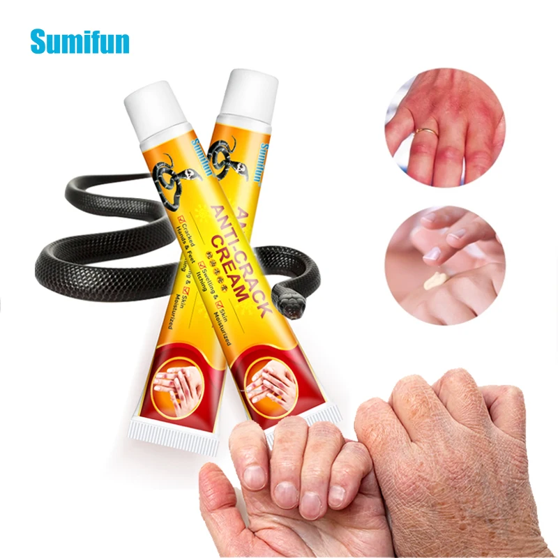 

1PC Snake Oil Repair Hand Rough Cream Dry Cracked Chapped Anti-chapping Moisturizer Plaster Heel Hand Cleft Healing Frostbite