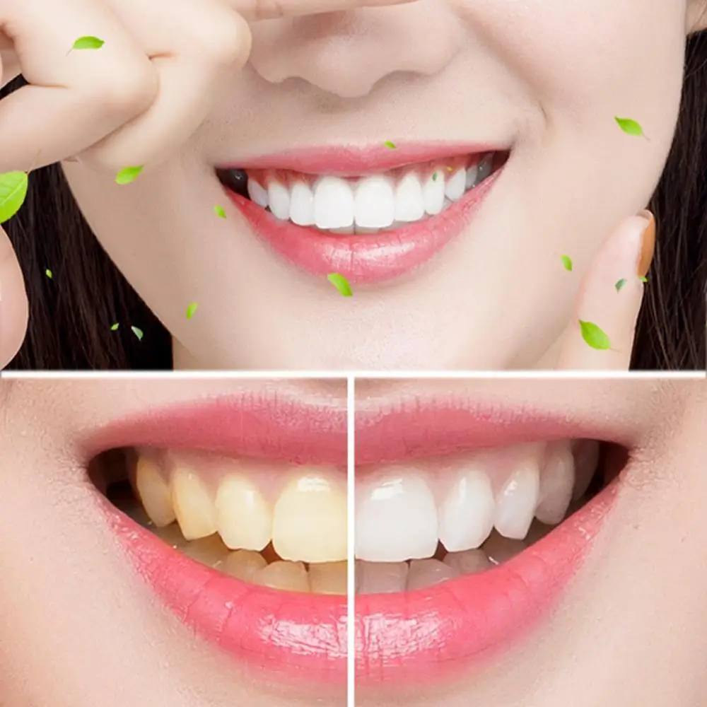 Средство для отбеливания зубов инструмент зубной пасты 60 г P6X3|Зубная паста| |