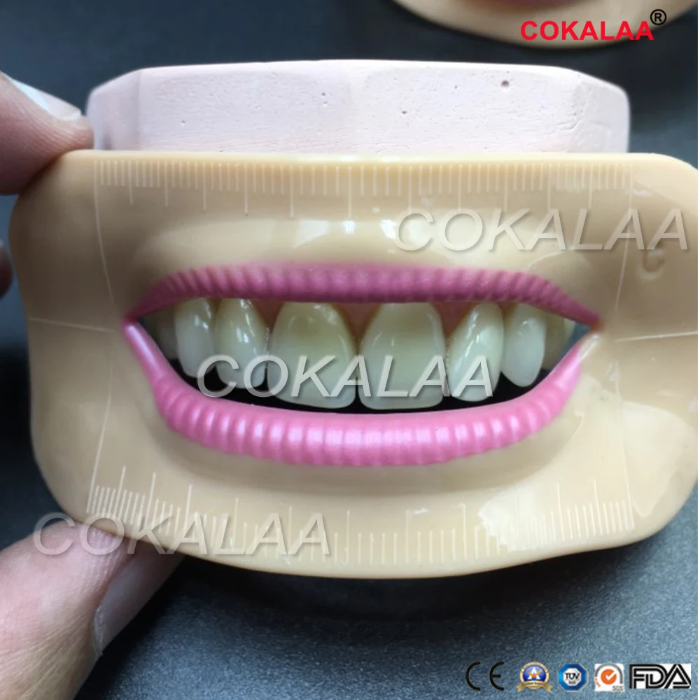 

Dental Lab Denture laboratory mouth measuring lip measurement tool aesthetics parts 4 pcs