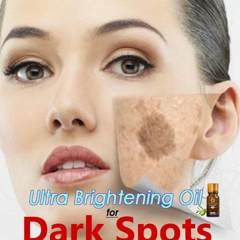 

Ultra Brightening Spotless Oil Skin Care Dark Spots Remove Ance Burn Strentch Marks Scar Removal lavender Essence