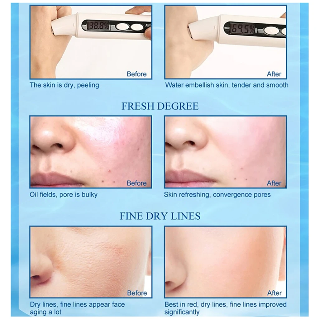 Beauty Yan Qiong Essence 30 мл отбеливающий крем увлажняющий Антивозрастной уход за кожей
