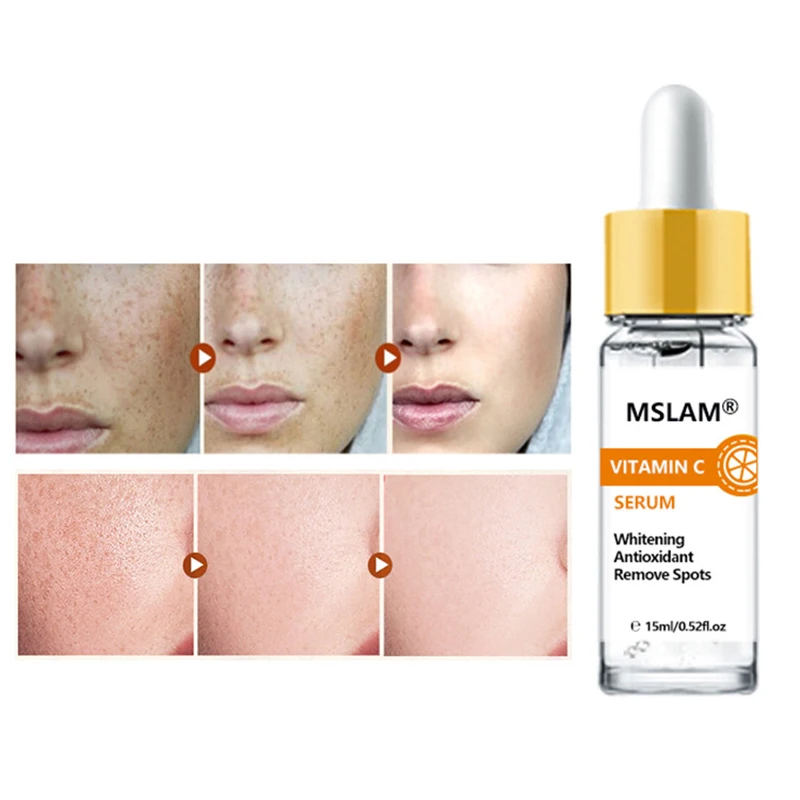 

Витамин C осветляющая эссенция выравнивает тон кожи уменьшить пятен отбеливающая Сыворотки термоусадочная пятна увлажняющий Уход за лицом...