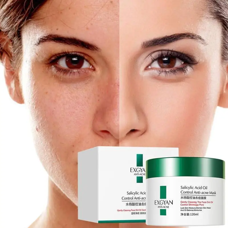 

120ml Salicylic Acid Mask shrink Pores Moisturizing Oil-control acne sleep acne remove fade marks Whitening mask W9Q7