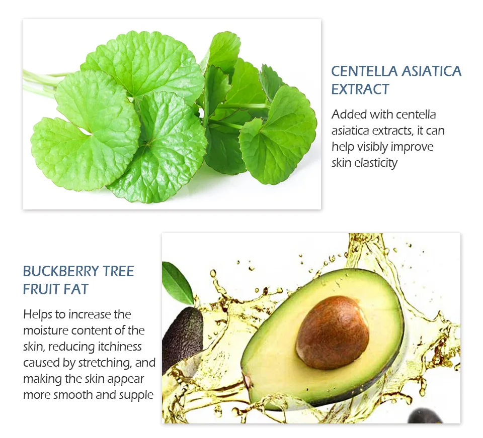 Крем от растяжек и шрамов 30 г TSLM2|Автозагары бронзаторы для тела| |