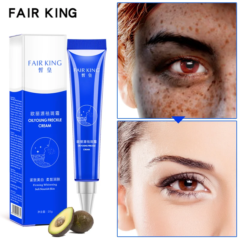 

Freckle Cream Brightening Whitening Remove Melasma Acne Spots Pigment Melanin Reduces Age Spots Face Cream Skin Care 20g TSLM2