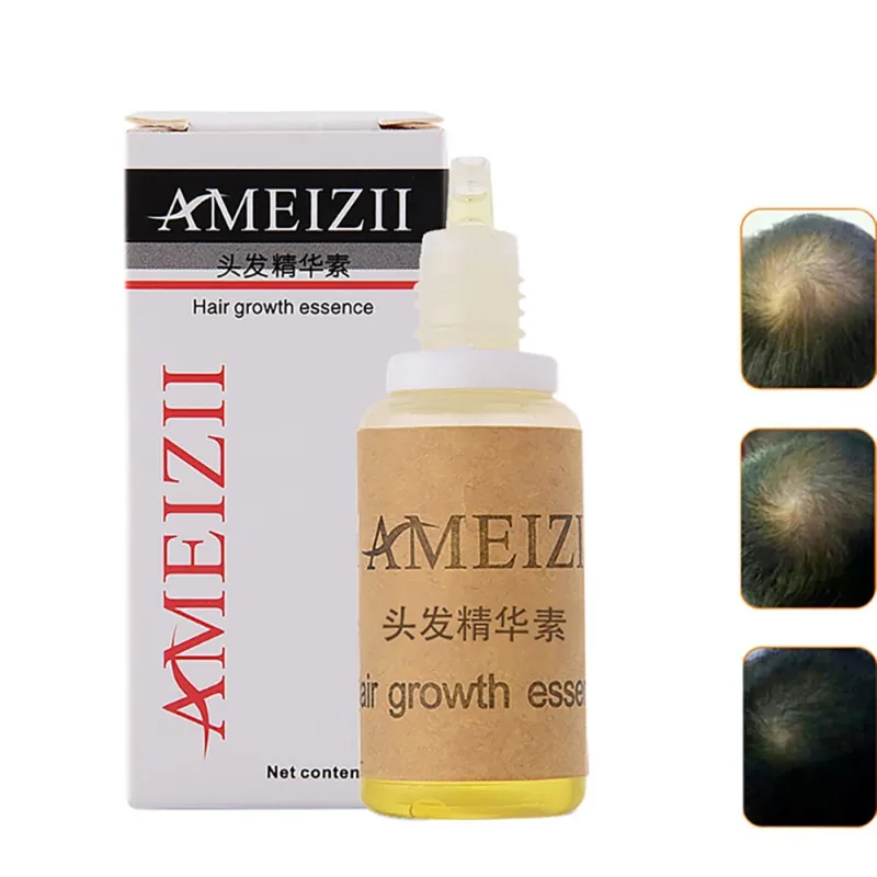 20 мл эссенция для роста волос выпадение жидких густых быстрый рост поставщик 1 |