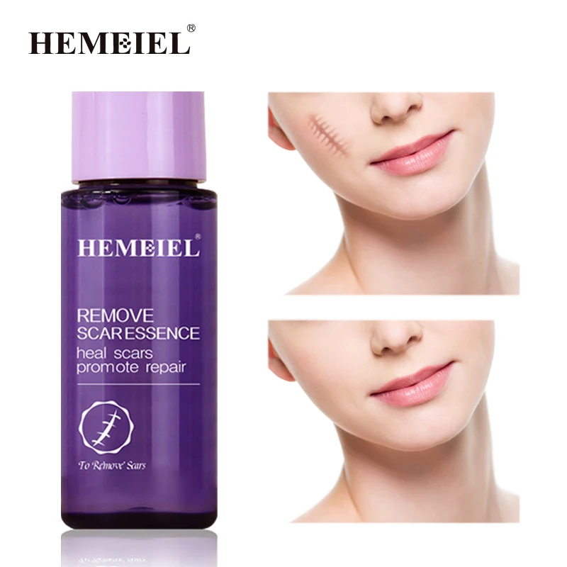 

Крем для удаления шрамов от прыщей, средство для восстановления кожи, средство для удаления шрамов, разглаживающий отбеливающий увлажняющи...