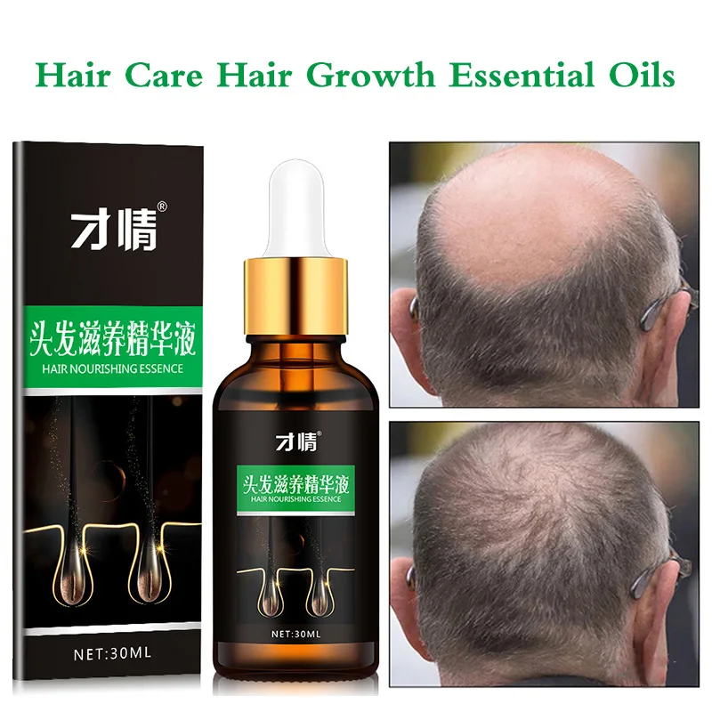 

Hair Care Hair Growth Essential Oils Essence Original Authentic 100% Hair Loss Liquid Health Care Beauty Dense Hair Growth Serum