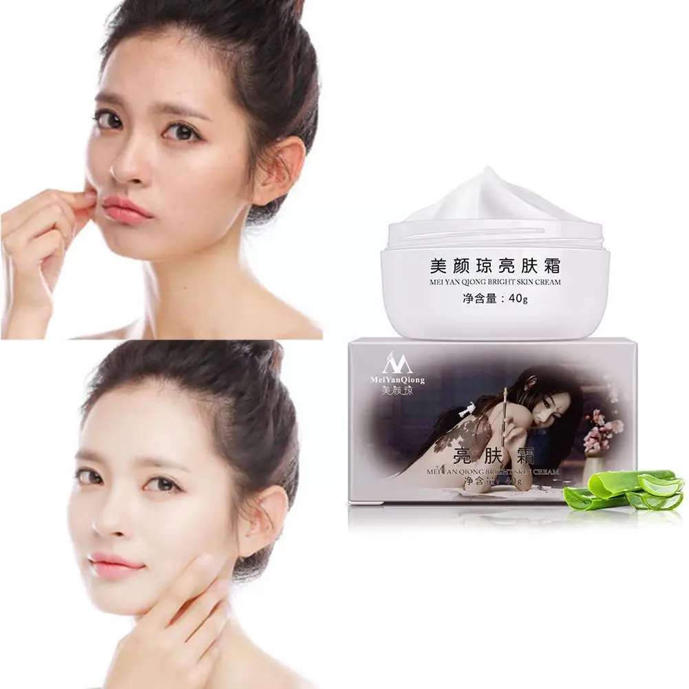 

40g Powerful Whitening Freckle Cream Remove Melasma Pigment Whitening Moisturizing Cream Effects Strong Acne Spots Skin Mel G2R8