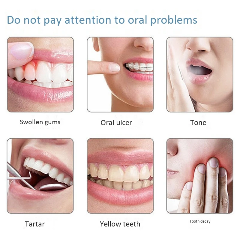 

Oral Irrigator USB Charging Wireless Water Tooth Cleaner Rechargeable Irrigator with 3 Modes 2 Nozzles